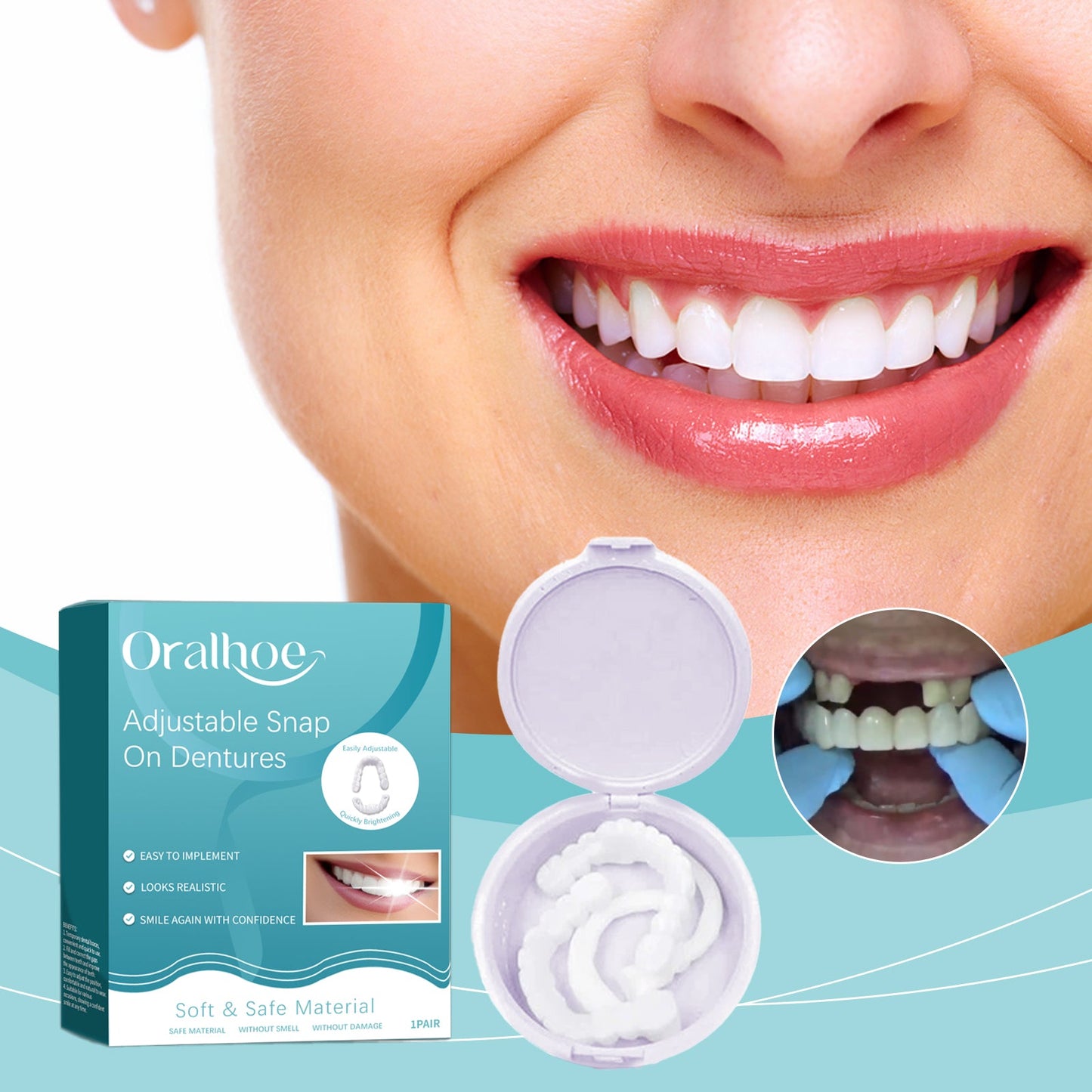 Adjustable Buckle Dentures for Comfortable Temporary Fillings