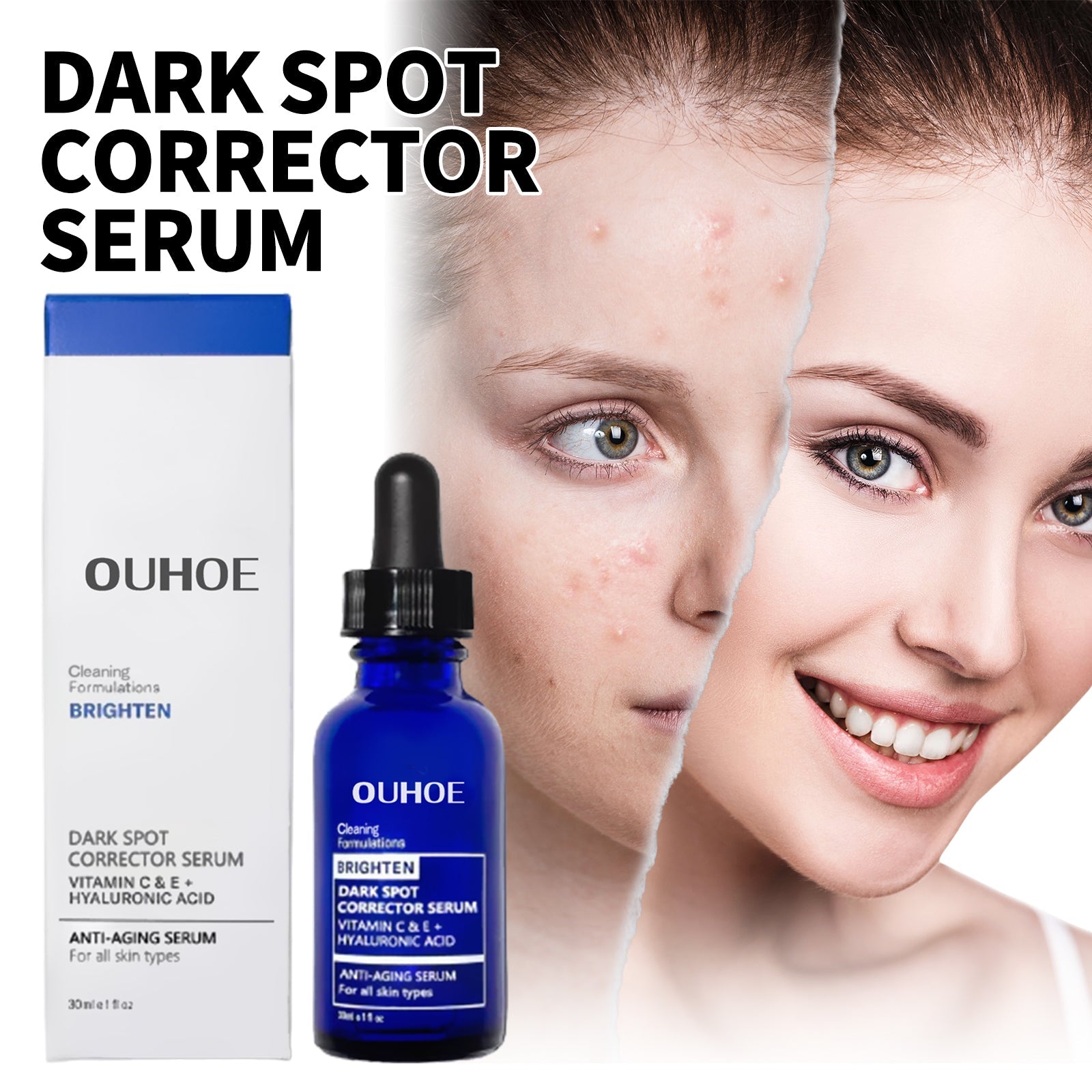 Dark Spot Repair Essence, Repair Acne Pimple Lightening Spot Fine Lines Moisturizing Firming Whitening Essence - Korvel