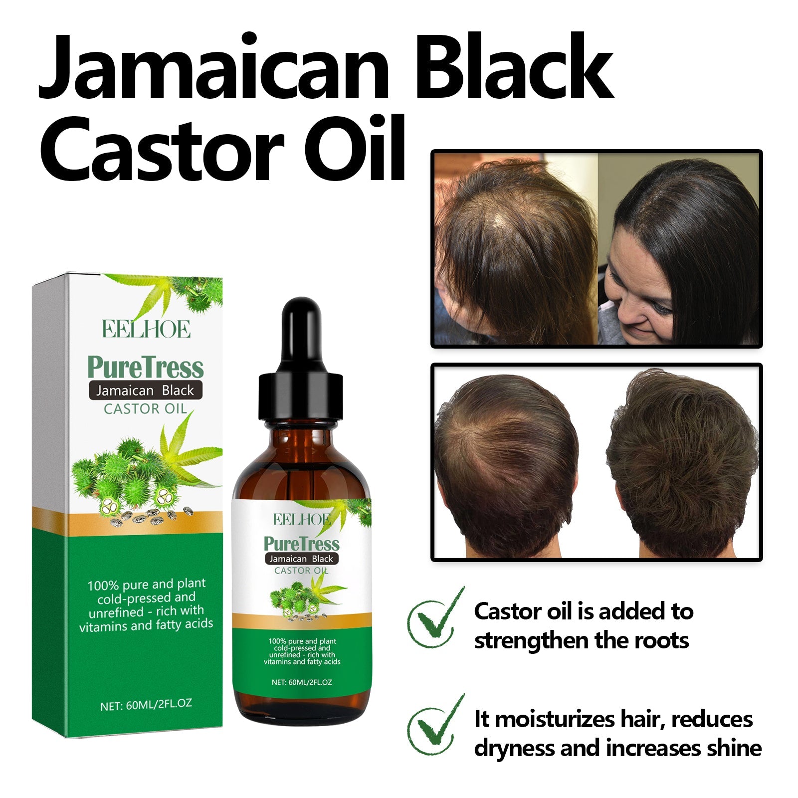 Jamaican Black Castor Oil, Moisturize Scalp And Prevent Dry Hair Thick And Solid Hair Beautiful And Shiny Easy To Absorb Essential Oils - Korvel