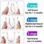 3 Stages Dental Orthodontic Braces Appliance Braces Alignment Trainer Teeth Retainer Bruxism Mouth Guard Teeth Straightener - Korvel