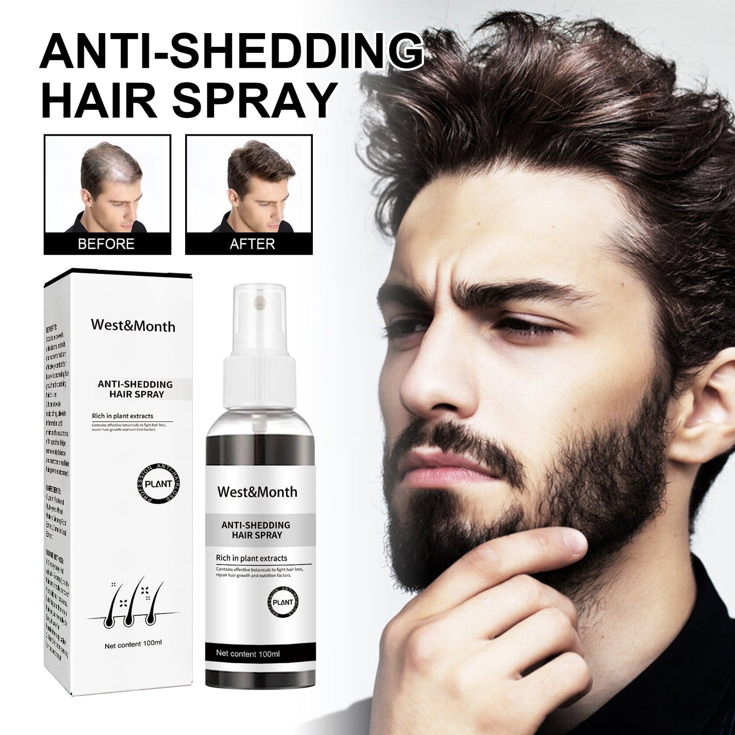 West & Month Anti-Shedding Hair Spray, Improve The Hairline Hair Hair Nutrition Moisture Hair Roots - Korvel