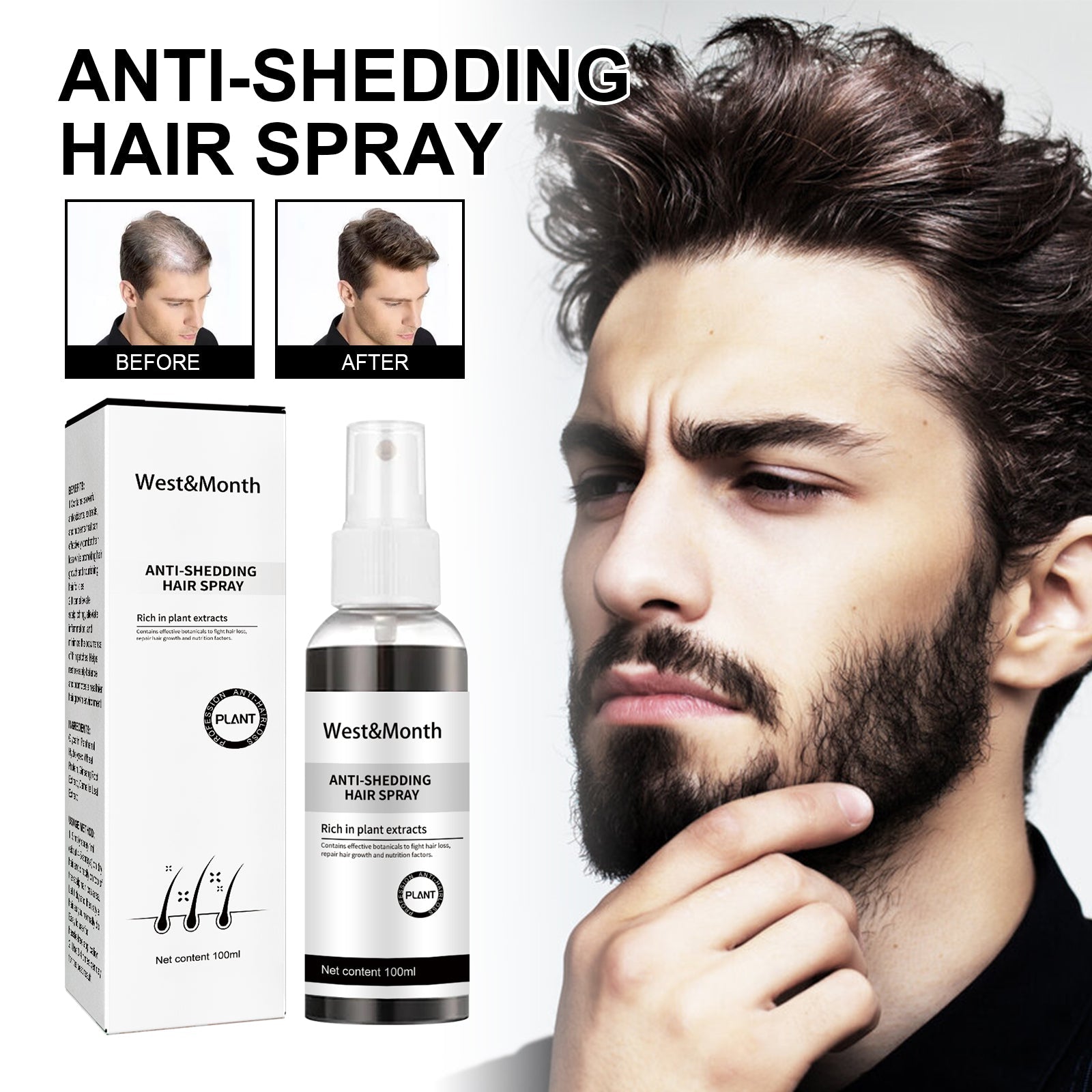 West & Month Anti-Shedding Hair Spray, Improve The Hairline Hair Hair Nutrition Moisture Hair Roots - Korvel