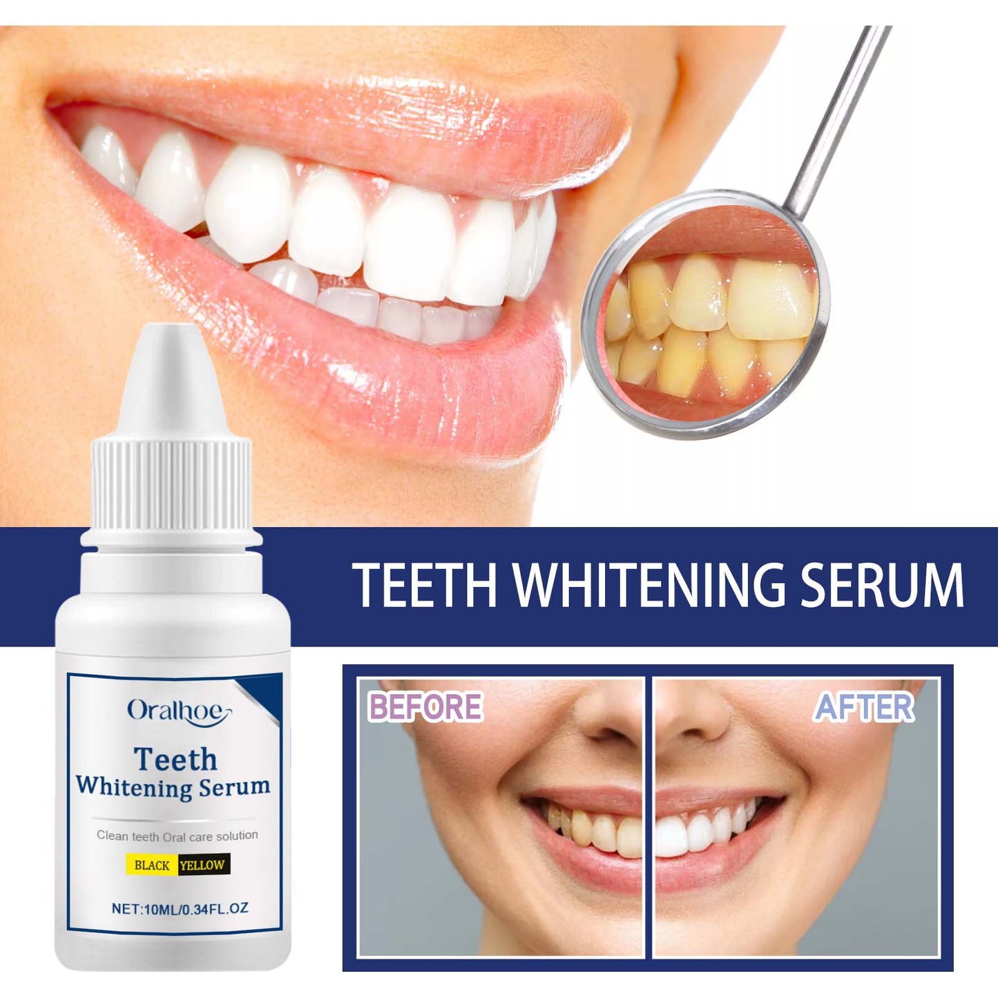 Premium Teeth Whitening Serum for a Radiant Smile