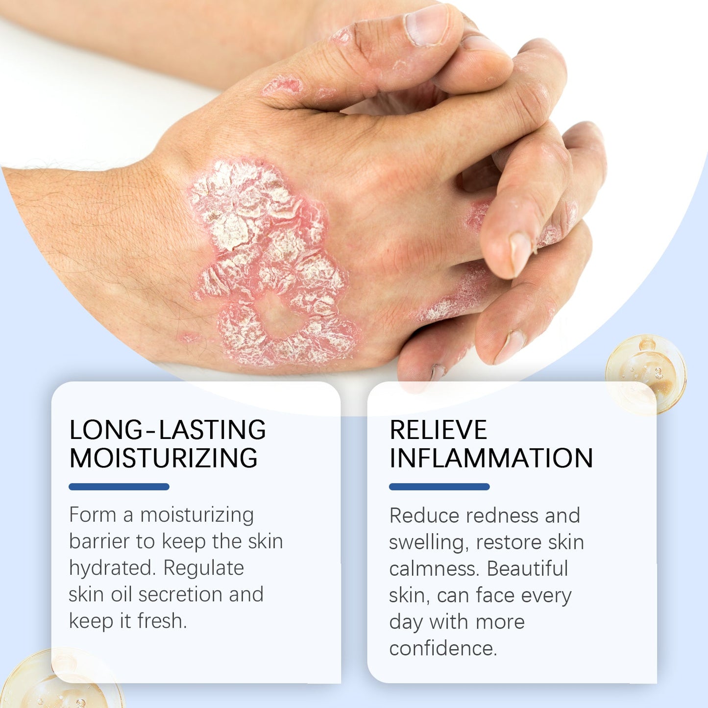 Bee Venom Skin Care Spray Moisturizes Skin And Restores Body Daily Care Topical Spray - Korvel