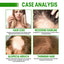 Premium Hair Root Spray for Nourished, Healthy Hair