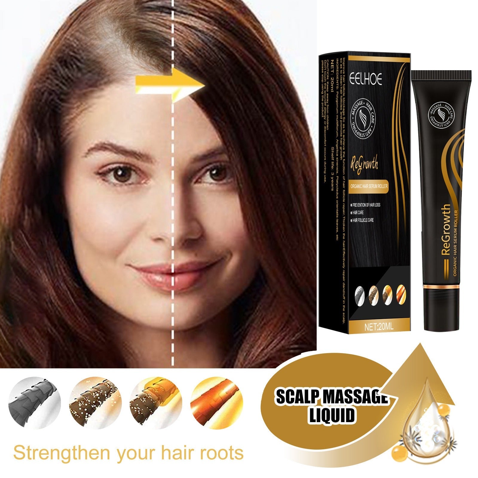 EELHOE Ball Bearing Dense Hair Essential Oil Thick Sparse Hair Bead Massage Scalp Care Fluid To Prevent The Loss Of Essential Oil - Korvel