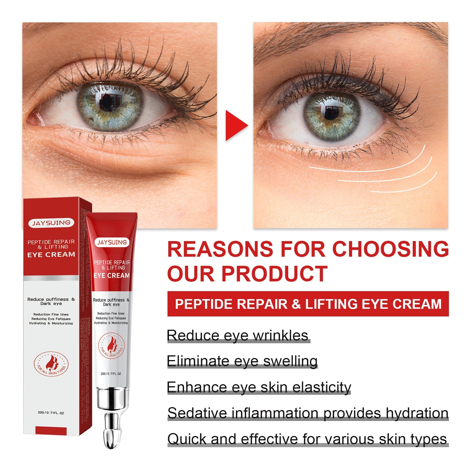 Nourishing And Moisturizing Eye Cream Keeps The Skin Around The Eyes Soft And Moisturized With A Gentle Daily Eye Cream - Korvel