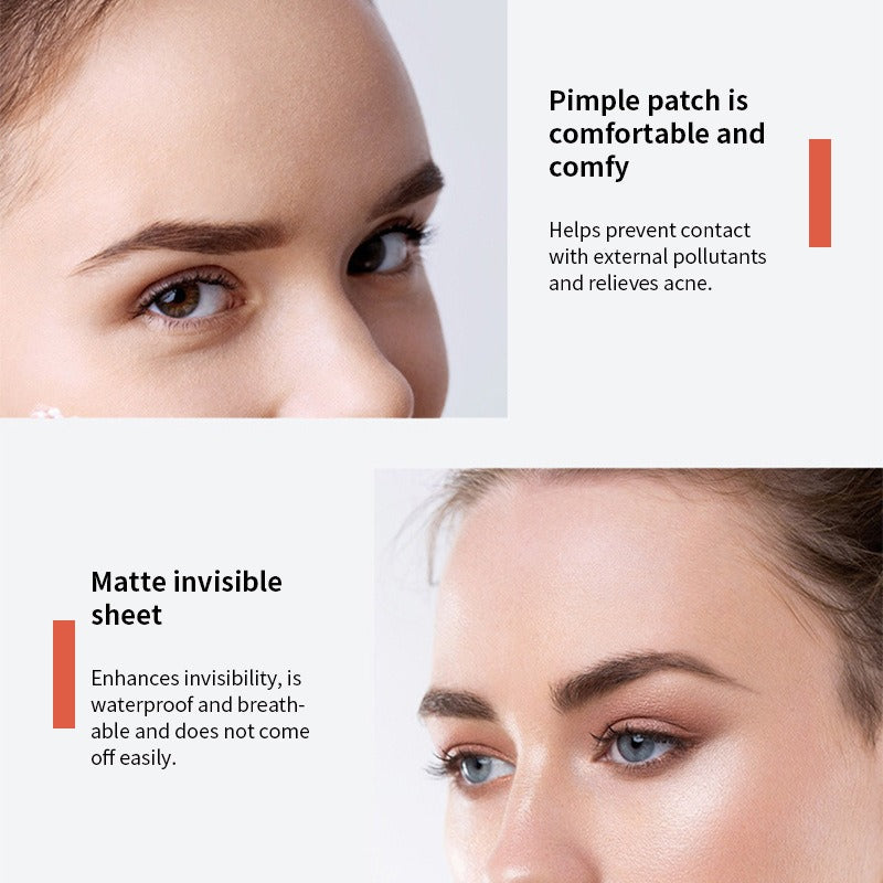 Youbuy Invisible Acne Patch Concealer - 72 Patches