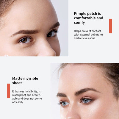 Youbuy Invisible Acne Patch Concealer - 72 Patches