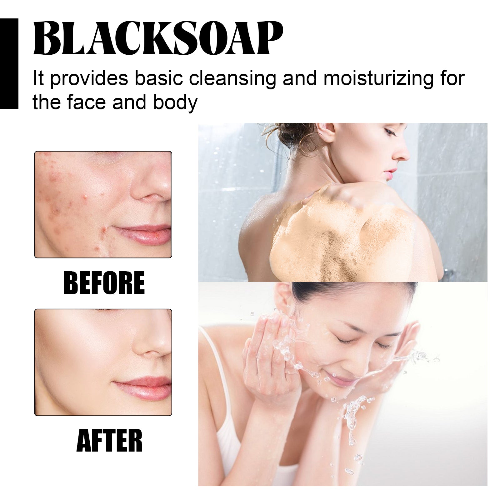 Shea Butter Black Soap, Repair Acne Pimple Acne Clear Pores Moisturize Smooth Skin Soap - Korvel