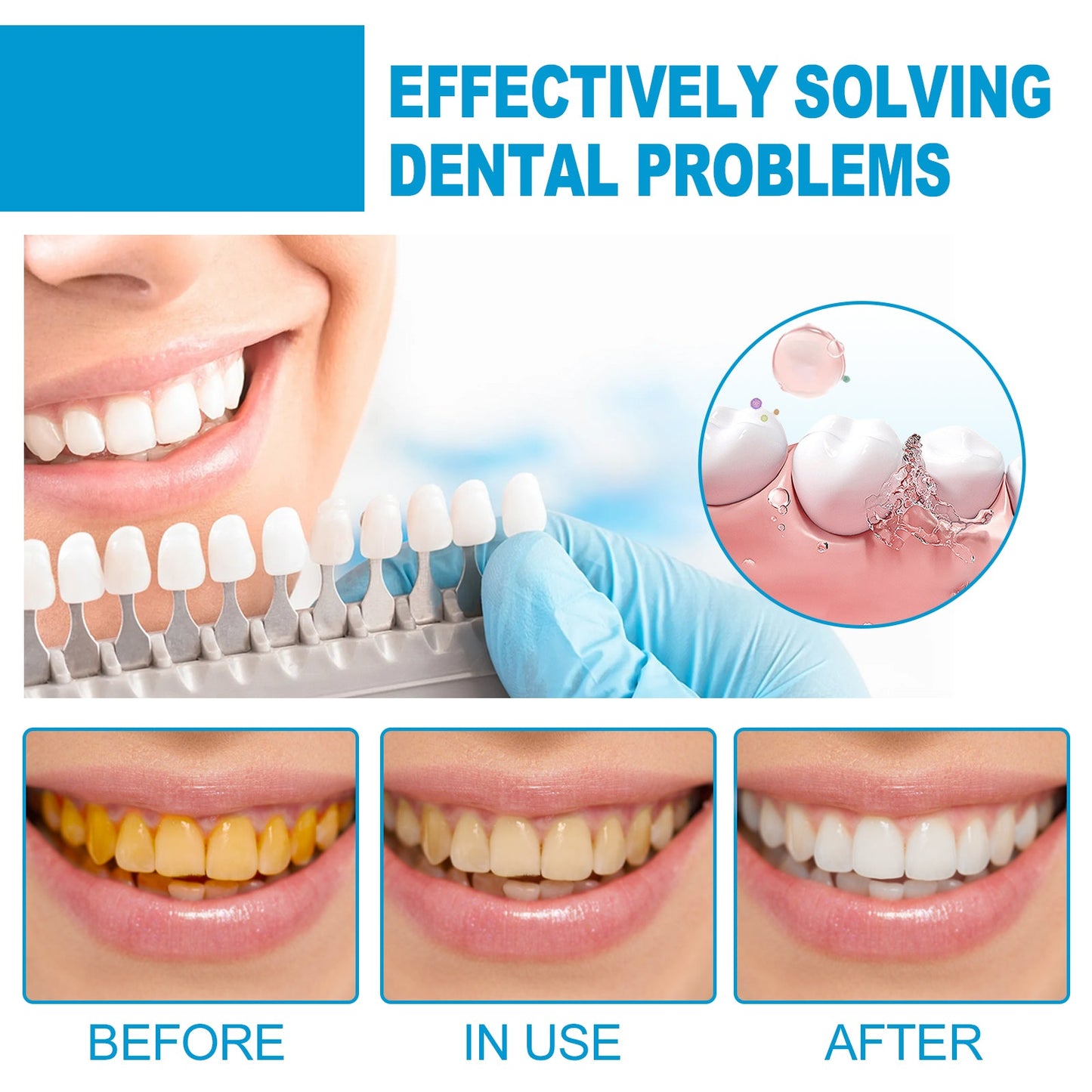 Mouth Mousse Toothpaste Teeth Clean Teeth Remove Tartar Stains Yellow Teeth Whitening Teeth Fresh Breath - Korvel