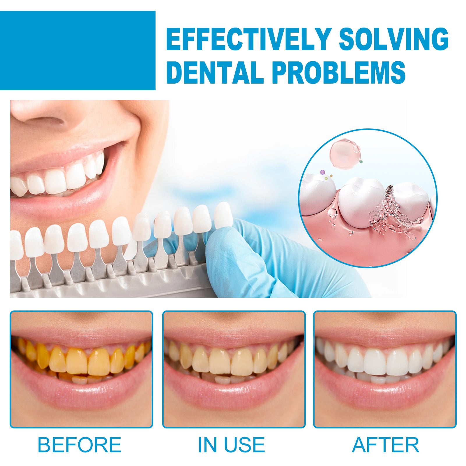 Mouth Mousse Toothpaste Teeth Clean Teeth Remove Tartar Stains Yellow Teeth Whitening Teeth Fresh Breath - Korvel