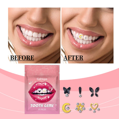 Crystal Dental Drill - Stylish Accessory for a Unique Smile