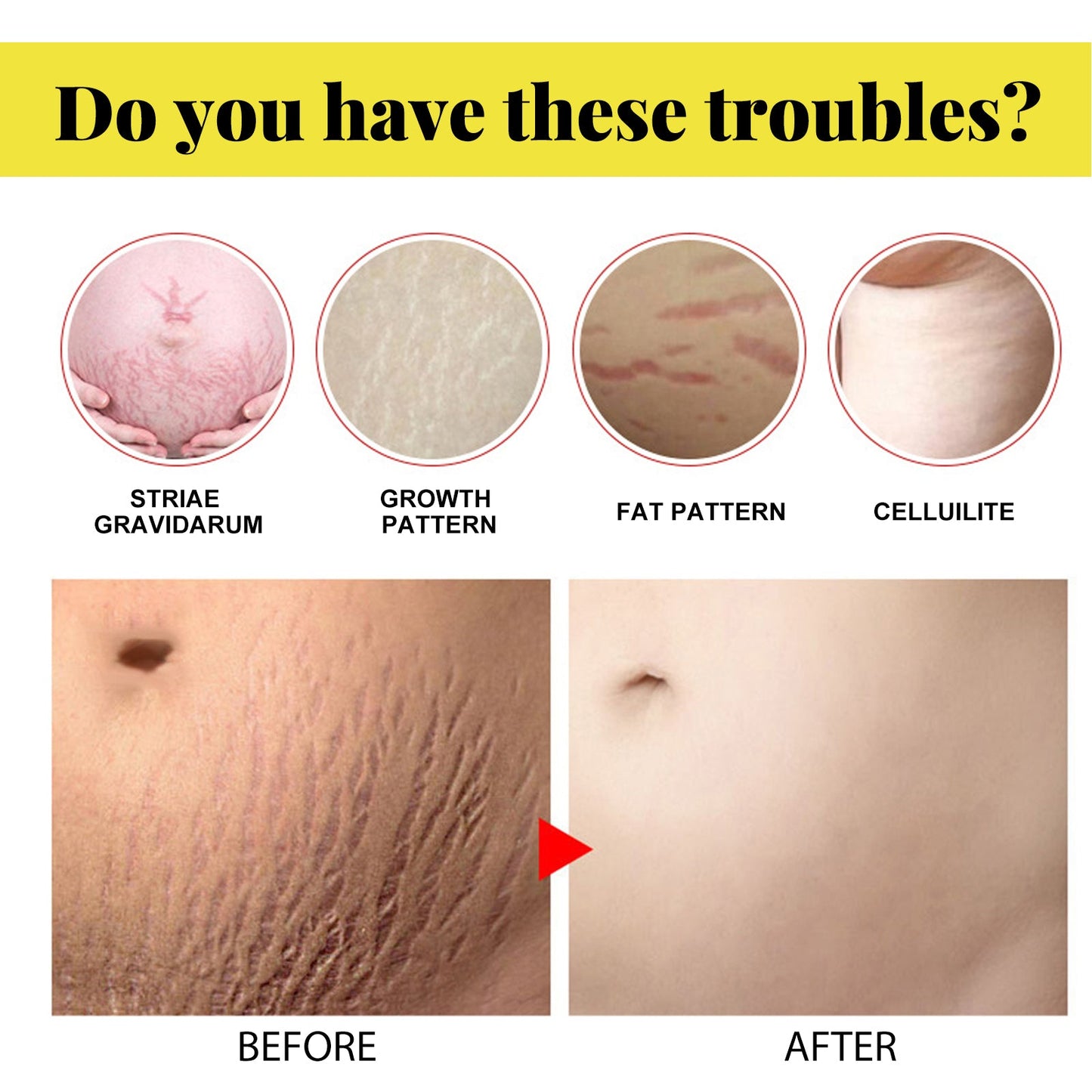 Crème hydratante douce pour femmes enceintes