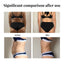 Belly Lift Tape, Lifts Loose Skin Tighten Shape Slim Belly Button Tape - Korvel