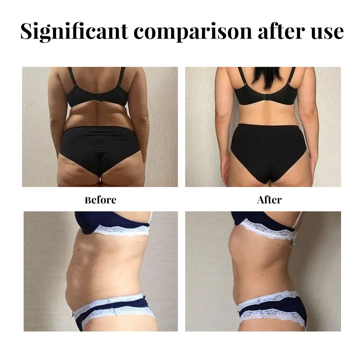 Belly Lift Tape, Lifts Loose Skin Tighten Shape Slim Belly Button Tape - Korvel