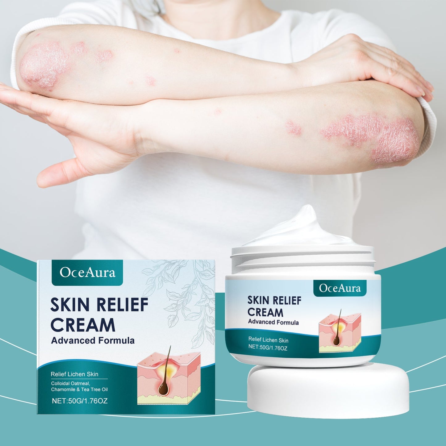 Hair Follicle Care Cream Care Scalp Back Face Clean Repair Acne Hair Follicle Care Cream - Korvel