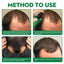 Men's Hair Serum For Hair Stabilization Nourishes And Nourishes Your Hairline - Korvel
