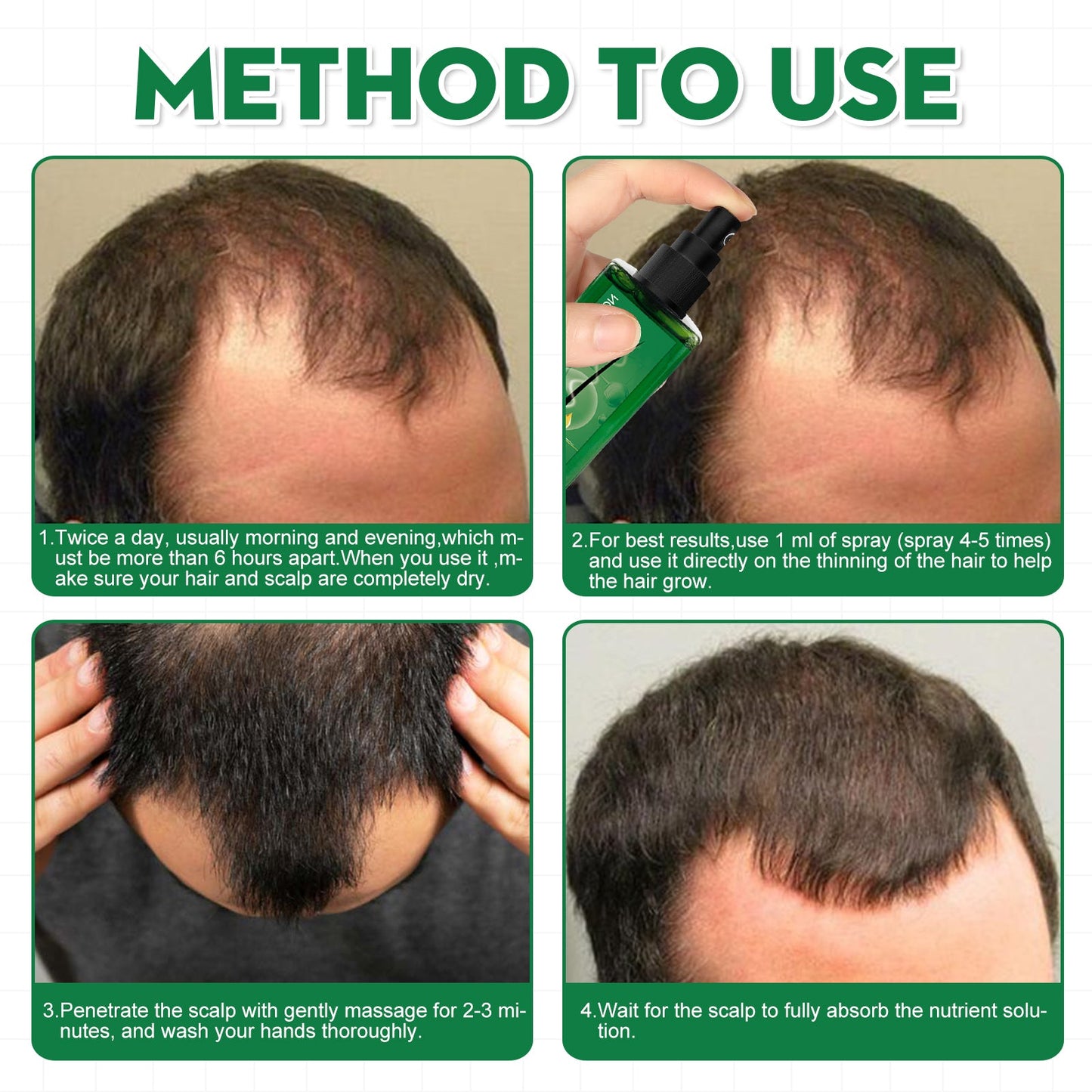 Men's Hair Serum For Hair Stabilization Nourishes And Nourishes Your Hairline - Korvel