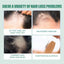 7 Days Essence Gently Moisturizes Hydrating Hairline Scalp Root Nourishing Hair Care Essential Oil - Korvel