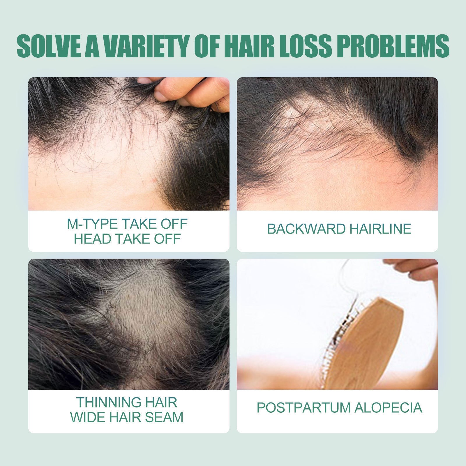 7 Days Essence Gently Moisturizes Hydrating Hairline Scalp Root Nourishing Hair Care Essential Oil - Korvel