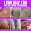 Remove Chicken Eye Lotion Extra Clear Remove Corns Skin Care Chicken Calluses Foot Pad Gram Warts - Korvel