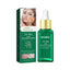 Tea Tree Oil Acne Serum, Remove Acne, Clear Acne, Repair Skin, Lighten Acne Printing Face Essence - Korvel