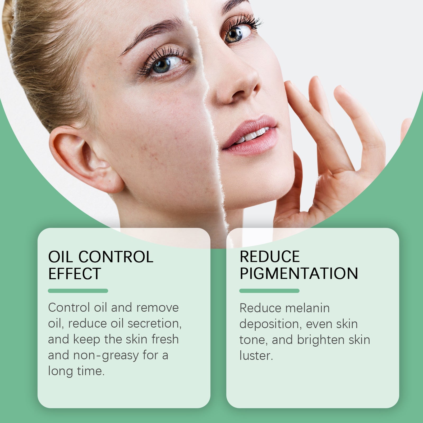 Azelaic Acid Essence Cream, Repair Moisturizing Moisturizing Face Oil Control Moisturizing Mild Refreshing Cream - Korvel