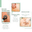 Body Acne Removal Cleanser Spray, Deep Clean Back Arm Fade Acne Beauty Moisturizing Spray - Korvel