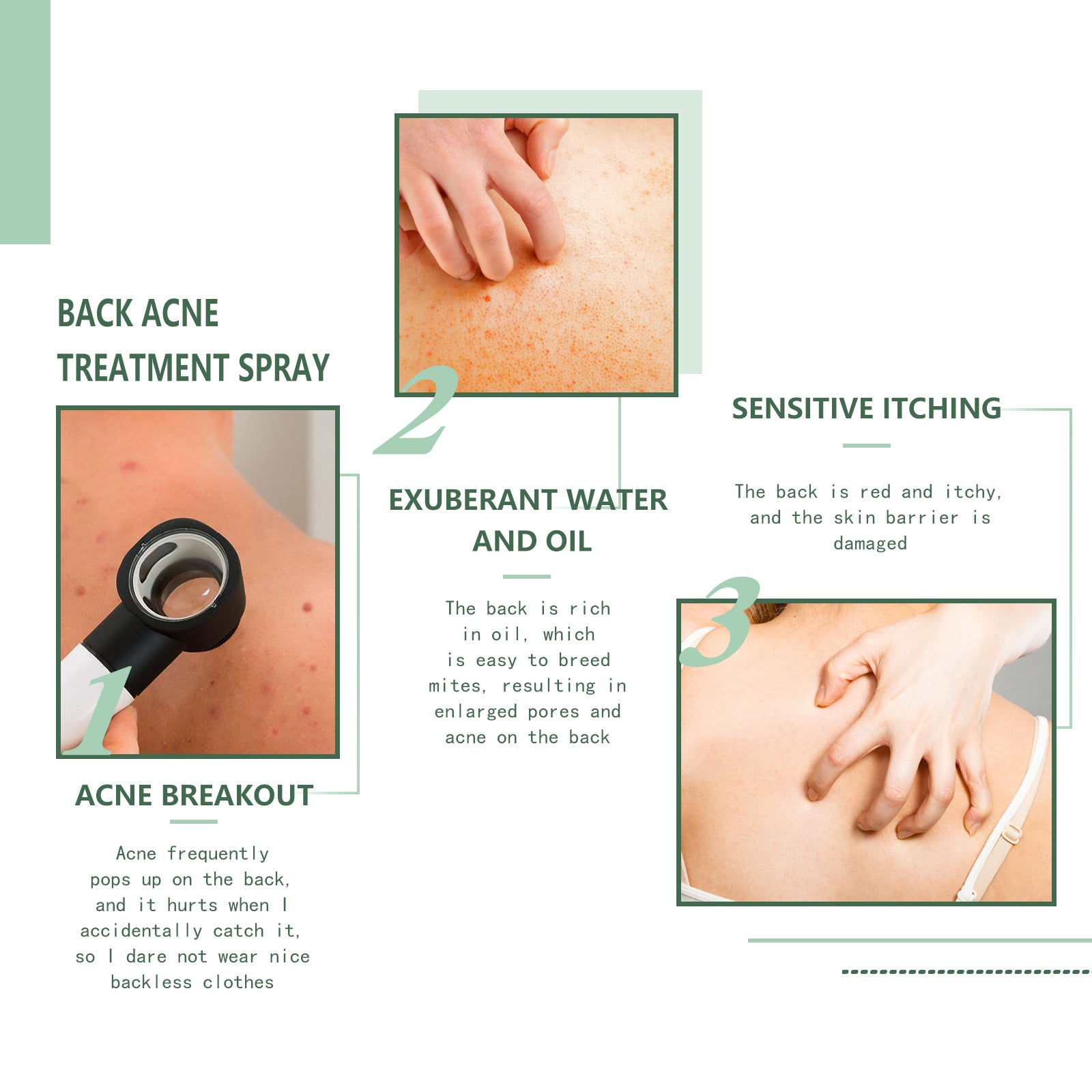 Body Acne Removal Cleanser Spray, Deep Clean Back Arm Fade Acne Beauty Moisturizing Spray - Korvel