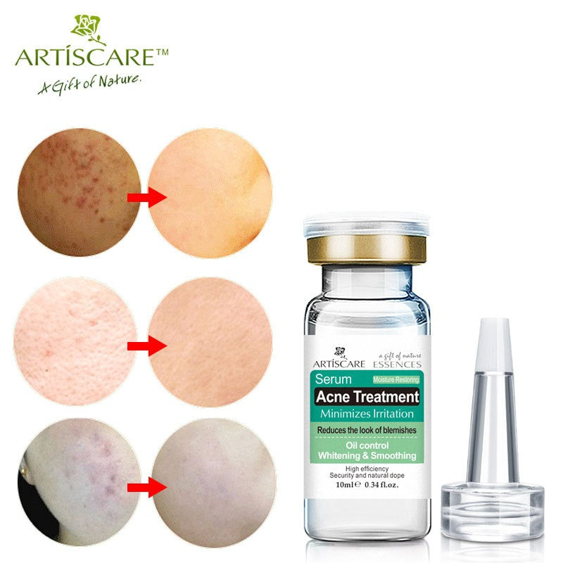 ARTISARE Acne Original Liquid essence - Korvel