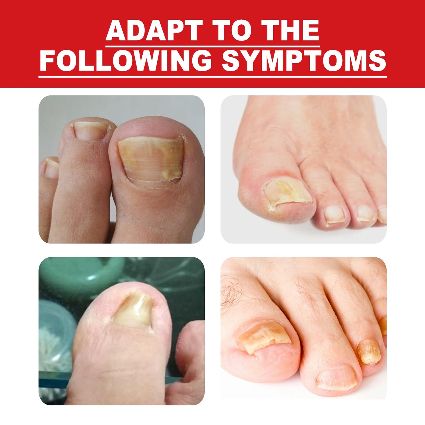 Toenail Repair Essence Moisturizes, Restores And Cleanses Foot Nails And Brightens With Essential Oil - Korvel
