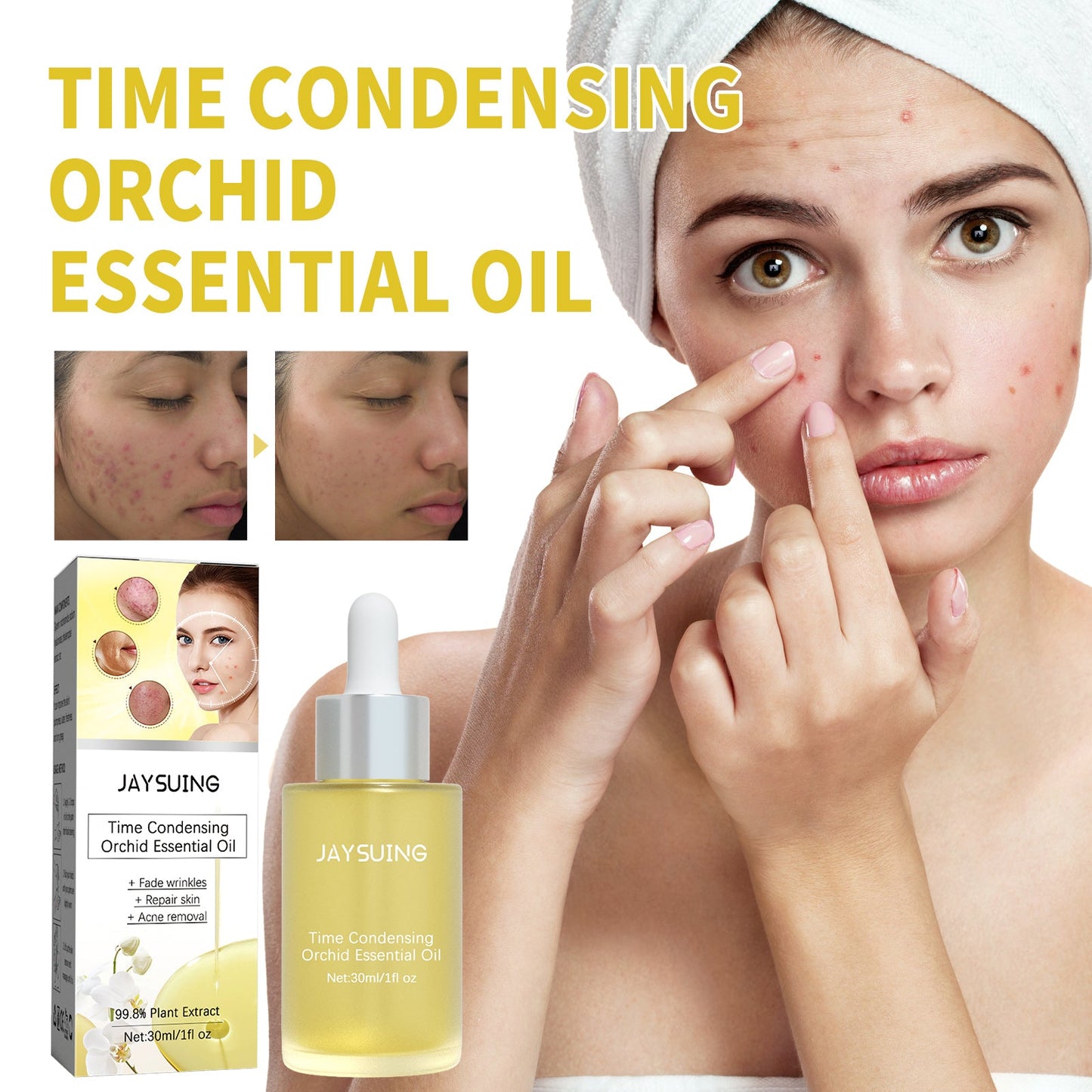 Orchid Acne Essential Oil Cleans And Brightens Pores And Hydrates Facial Care Essence - Korvel