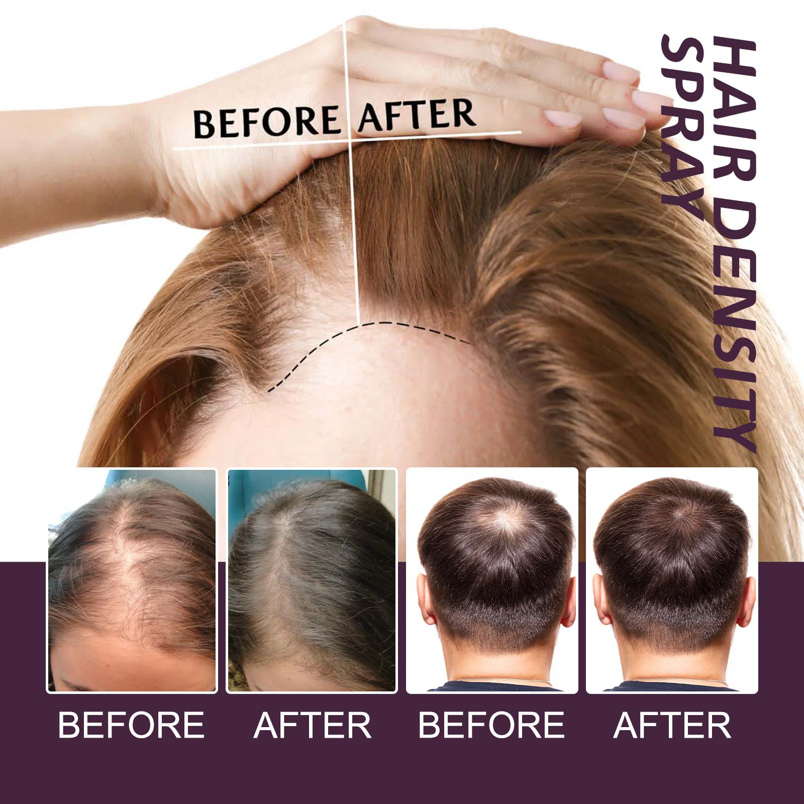Volumizing And Dense Hair Spray, Repair Dry Hair, Strengthen Hair Nourishing And Volumizing Hair Treatment Spray - Korvel