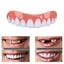 Veneers Sourire Parfait pour un Look Confiant