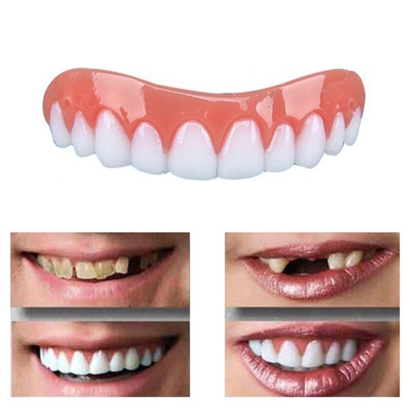 Veneers Sourire Parfait pour un Look Confiant