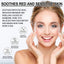 Facial Treatment Essence, Lighten Facial Acne Mark Oil Control Firming Skin Essence - Korvel