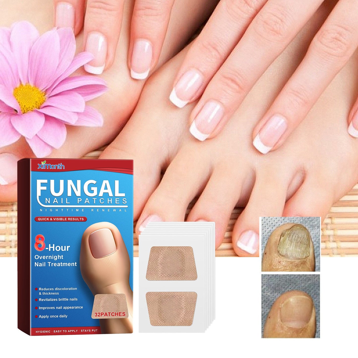 Nighttime Renewal Fungal Nail Patches, Repair And Thickening Gray Nail Insert Soft Nail Care Patch - Korvel