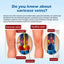 Varicose Vein Slimming Cream, Vein Repair Body Care Reduces Leg Muscle Swelling Earthworm Leg Slimming Cream - Korvel