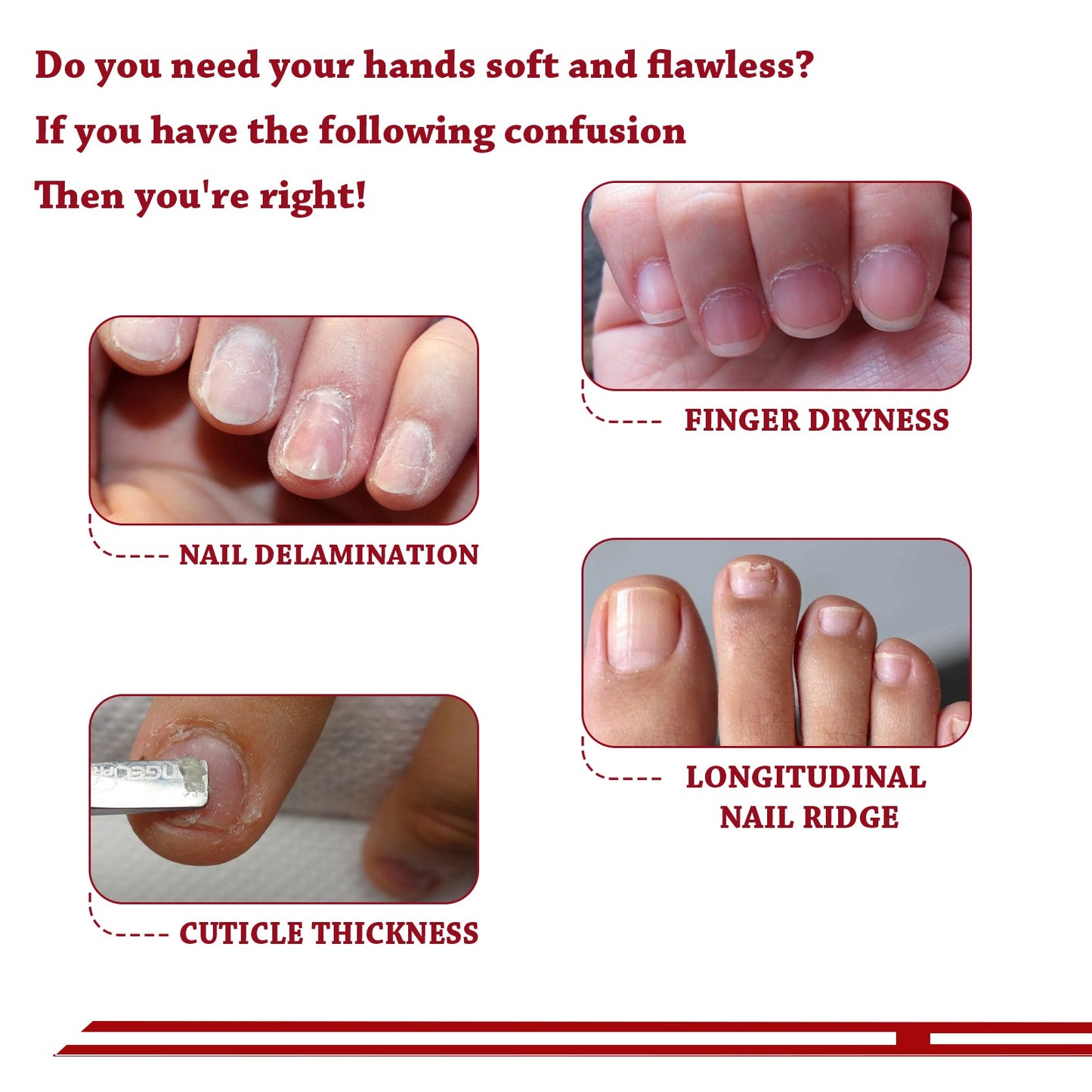 Cuticle Oil, Strengthen Nail Cuticle Moisturize Nourishing Nail Edge Nail Care Oil - Korvel
