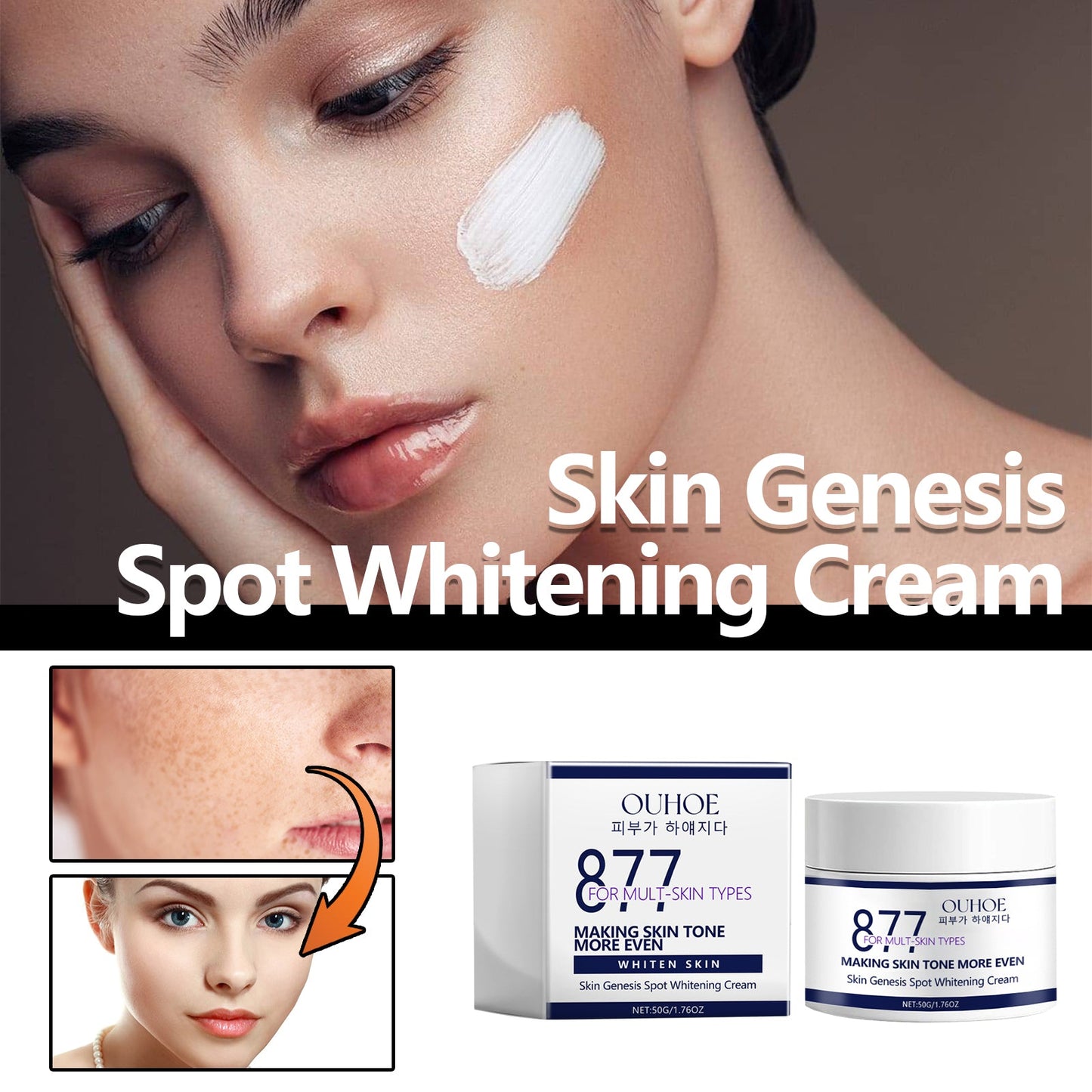 Skin Genesis Spot Whitening Cream, Moisturizing and rejuvenating Skin Whitening body Skin care cream - Korvel