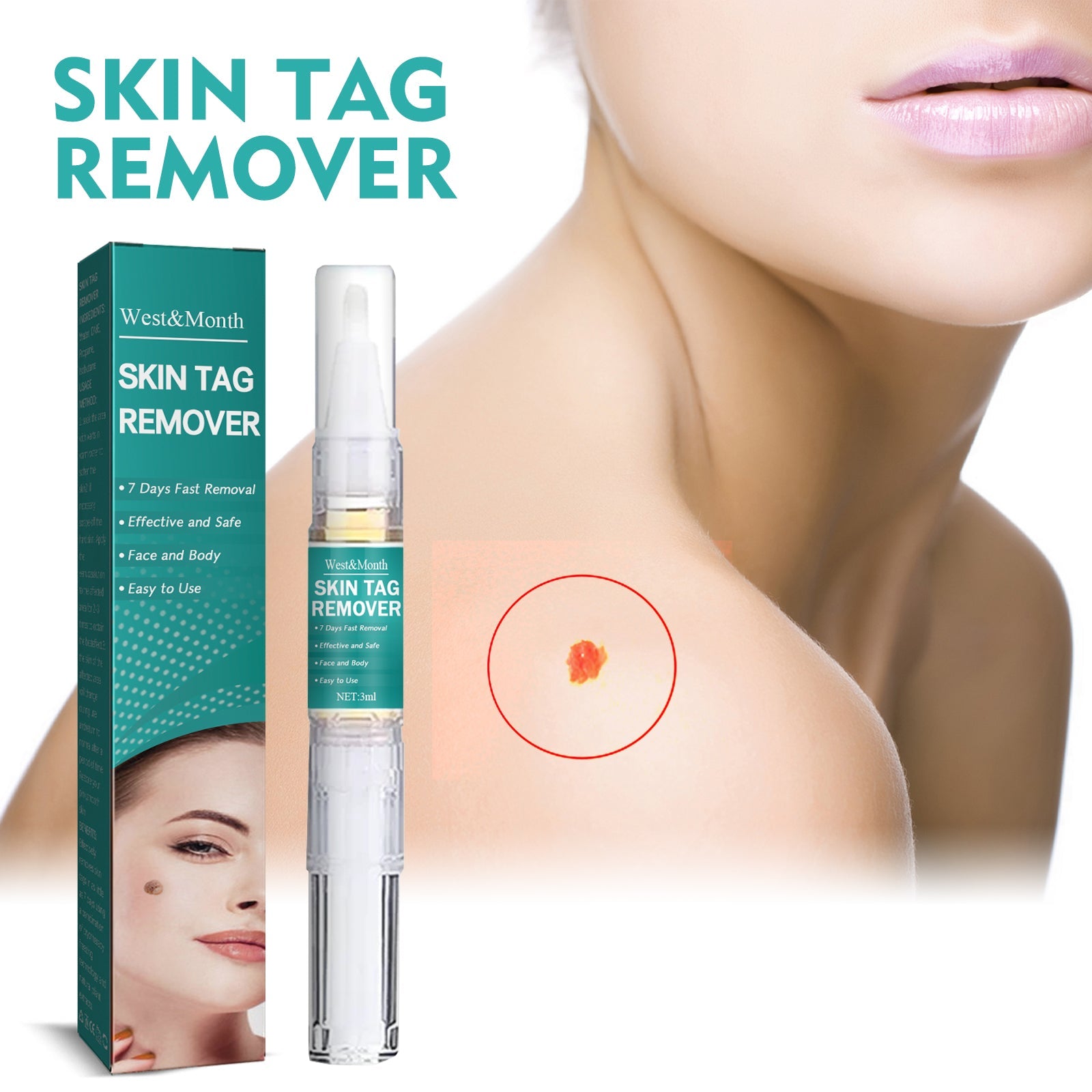 Gram Verruca Pen, Deep Cleaning Gram Verruca Remove Corns Meat Granules Repair Smooth Skin Anti-Verruca Liquid - Korvel