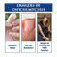 Nail Care Repair Pencil for Healthy Nails