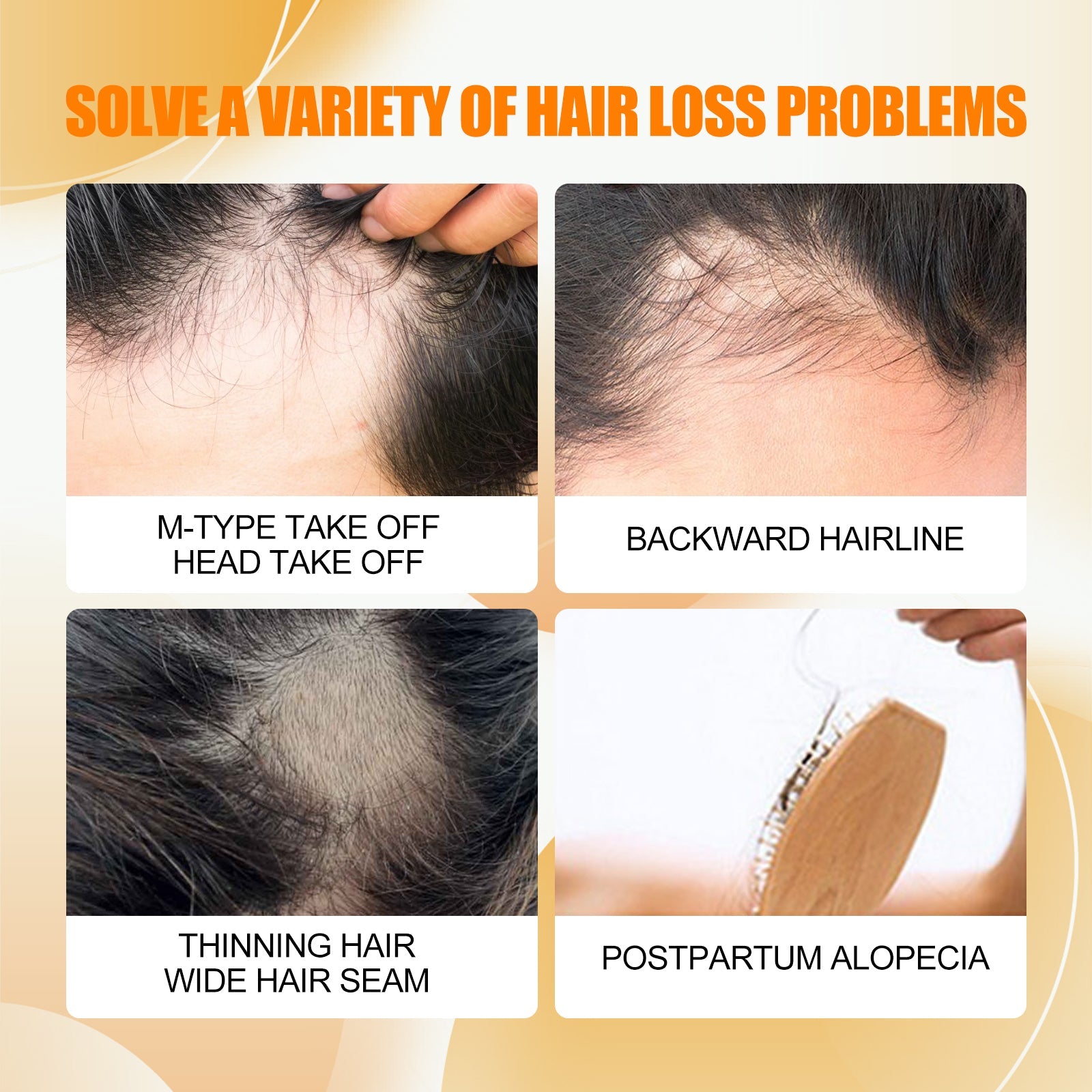Hair Growth And Care Oil, Repair The Hair Dry Deep Moisturizing Smooth Hair Knot Not Dense Hair Oil - Korvel