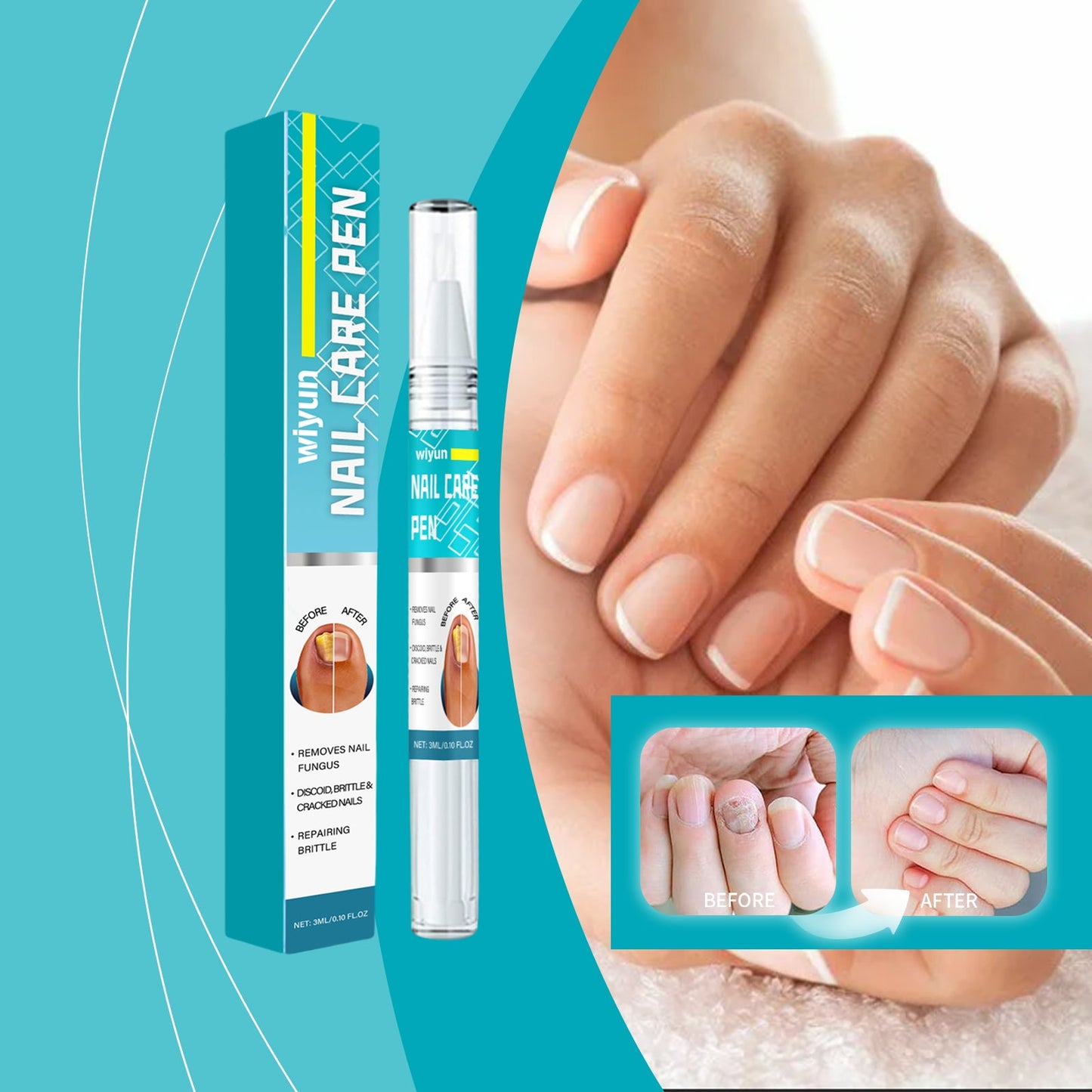 Nail Repair Pen, Foot Hand Moisturizing Care Nail Face Guard Fingertip Beauty Care Pen - Korvel