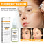 Turmeric Whitening Spot Serum, Lighten Freckle Spots Brightening Skin Hydrating Serum - Korvel