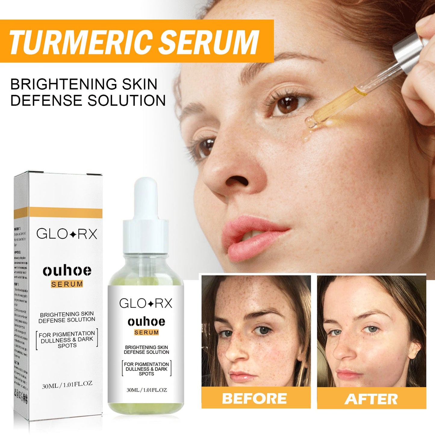 Turmeric Whitening Spot Serum, Lighten Freckle Spots Brightening Skin Hydrating Serum - Korvel