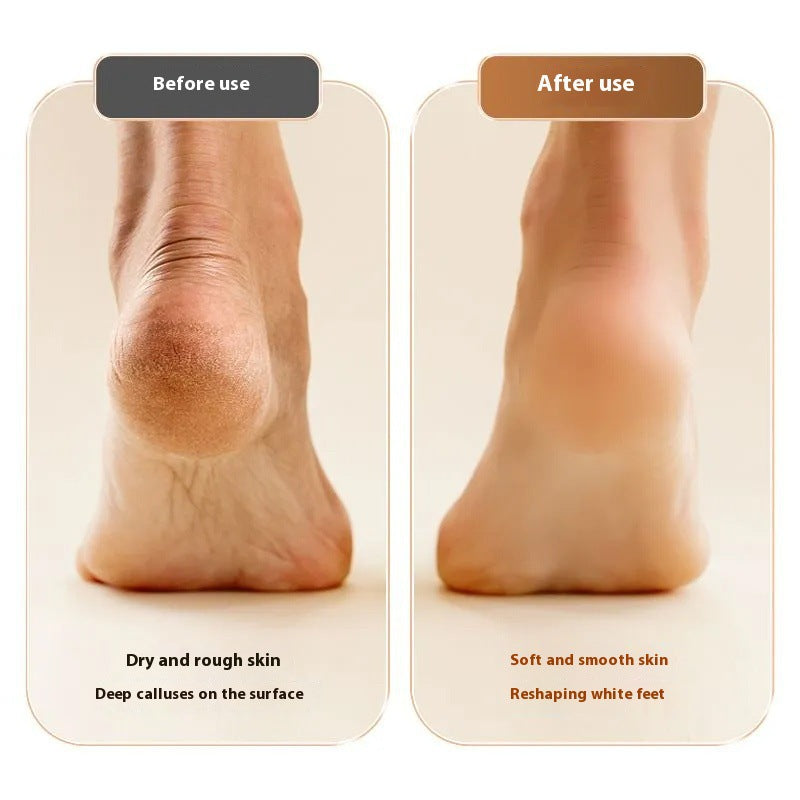 Electric foot grinder for removing dead skin and calluses, foot repair device for grinding stone heels, automatic home use foot - Korvel