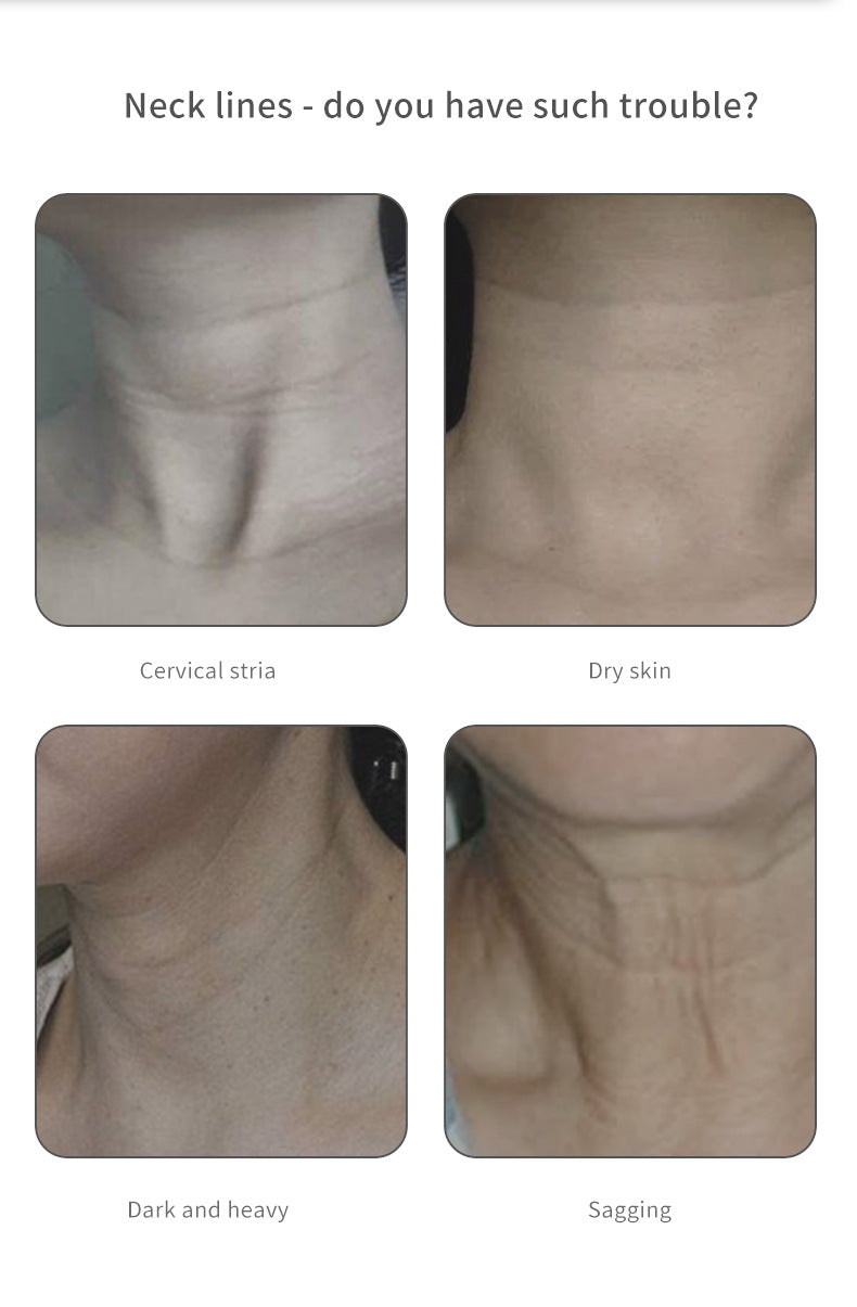 Neck Beautifying Instrument Fishtail Neck Massage To Remove Fine Lines With Color Light Micro Current Can Heat Swan Neck Electric Massage - Korvel