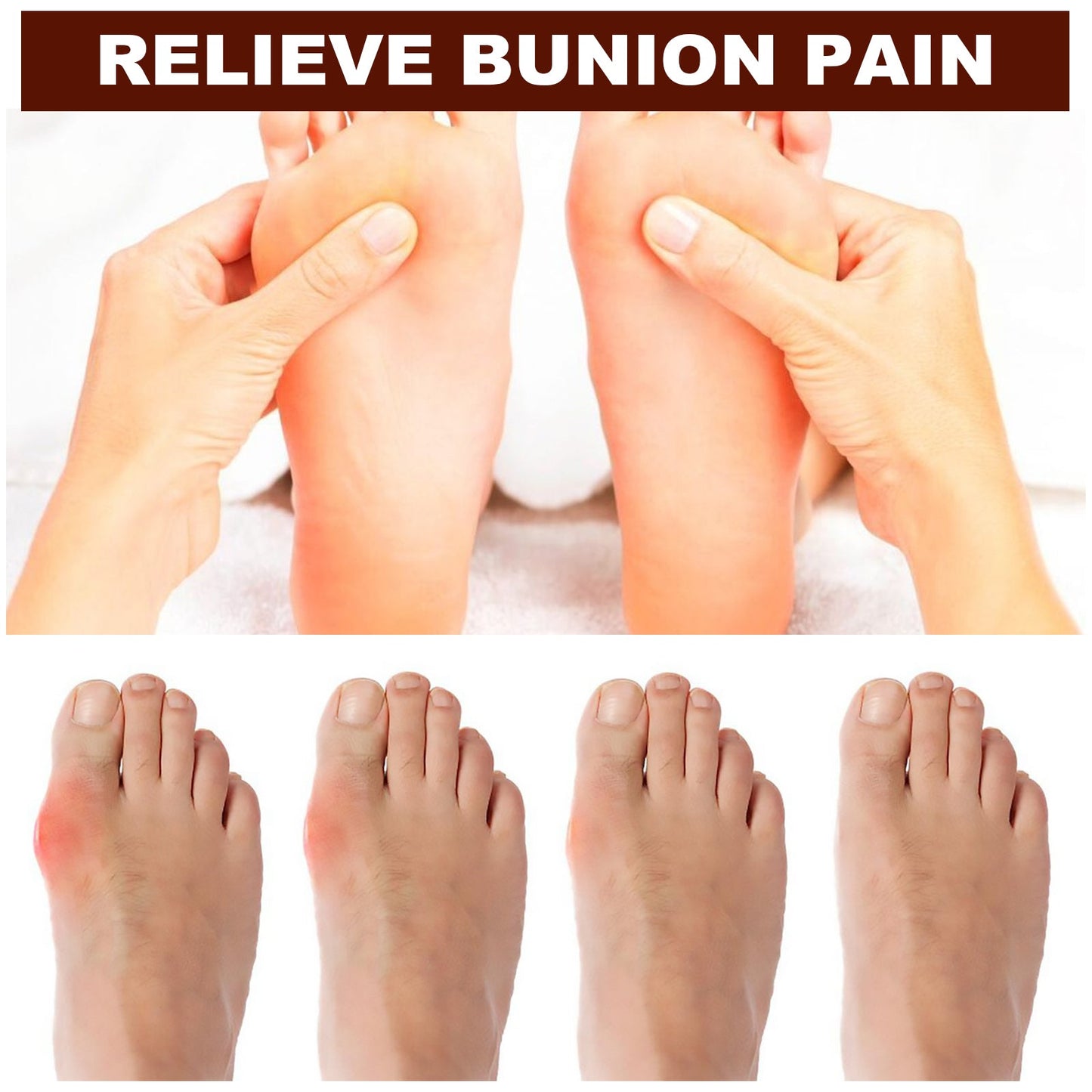 Bunion Essential Oil Roller For Pain Relief Massage Essential Oil Ball Foot Care Convenient Correction Of Thumb Valgus - Korvel